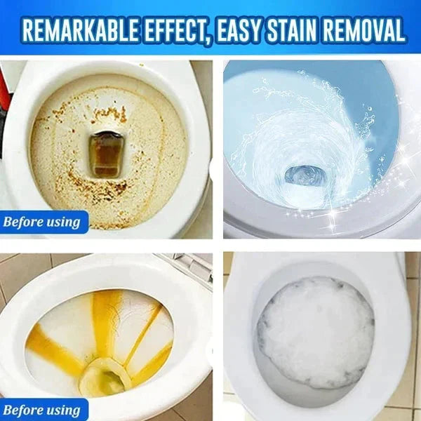 Concentrated Toilet Cleaning Agent Buy 1 Get 1 Free😍